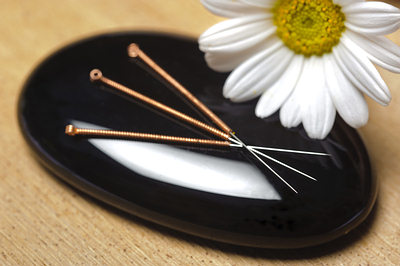 acupuncture-needles-natural-opt