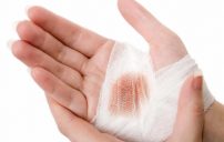 علاجات منزلية لجروح الجلد 1