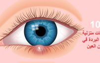 علاج البردة في العين 2